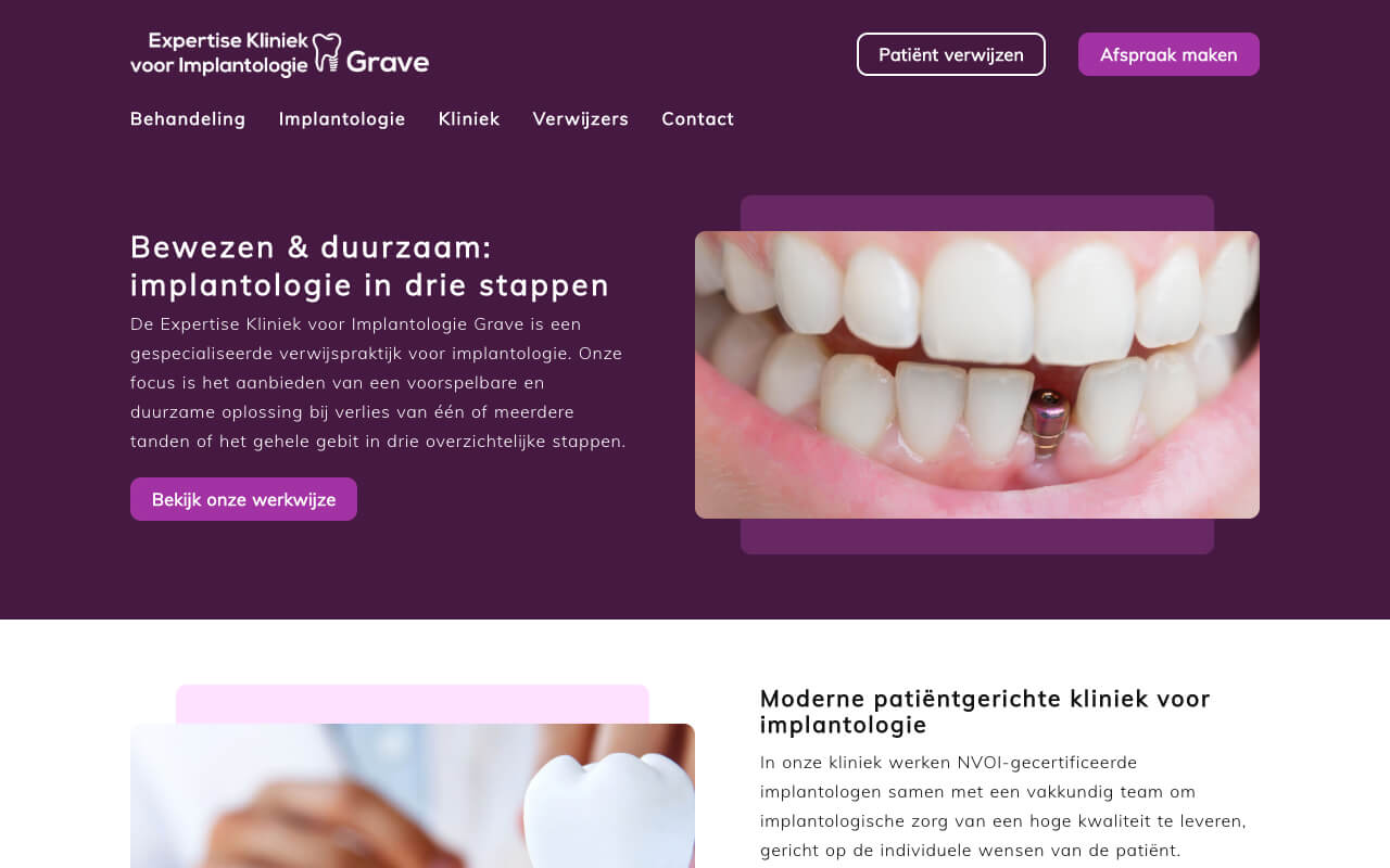 Website ontwikkeling voor de Expertise Kliniek voor Implantologie Grave